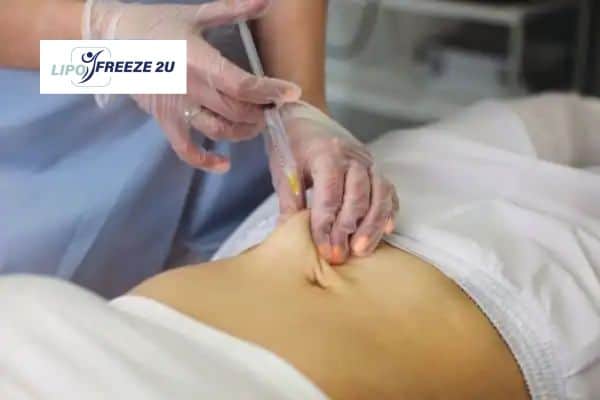 How Does Aqualyx Fat Dissolving Injection Work to Break Down Fat Littlehampton?