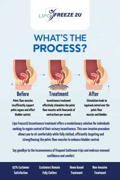 Diagram of how incontinence treatment Littlehampton works.