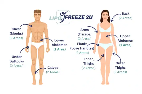 Areas you can have fat freezing treatment Littlehampton