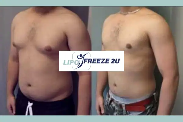 How Long Does It Take to See Results Littlehampton?